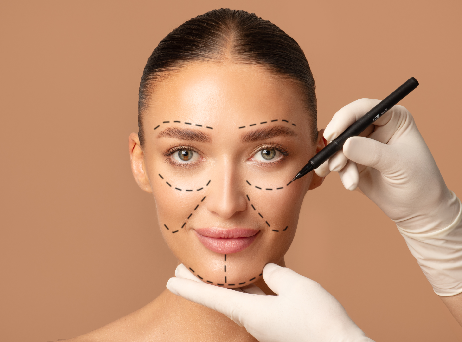 Face Lift